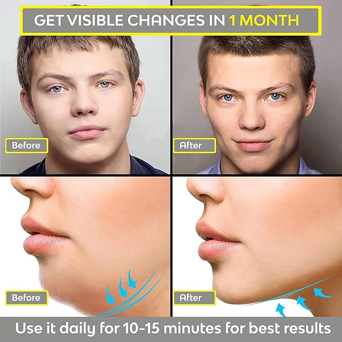 Jawline Exerciser – Face & Neck Toning Tool for a Defined Jawline